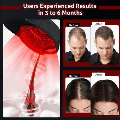 Rechargeable Controller 4 Modes with Adjustable Luminance At-Home Scalp Care Hair Growth Cap for Men & Women