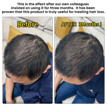Rechargeable Controller 4 Modes with Adjustable Luminance At-Home Scalp Care Hair Growth Cap for Men & Women